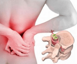 Lumgo kasalligi boshida osteochondroz