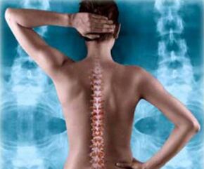 Orqa miya bilan rasm