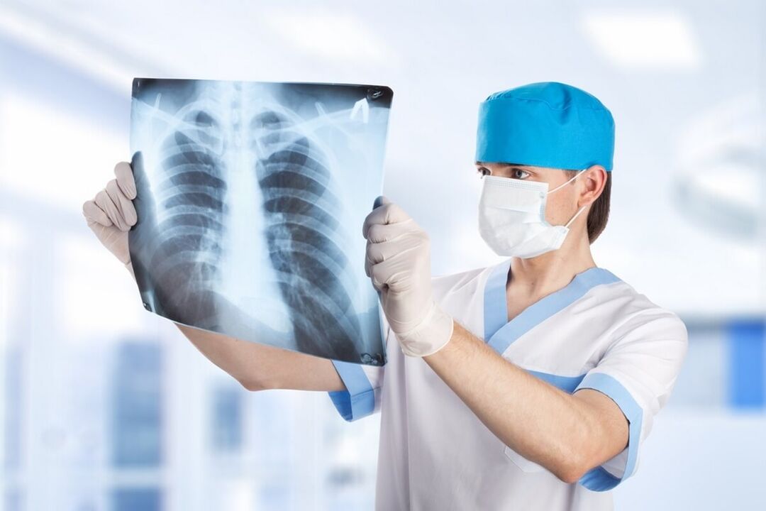 Osteoxondroz bilan ko'krak qafasining rentgenogrammasi